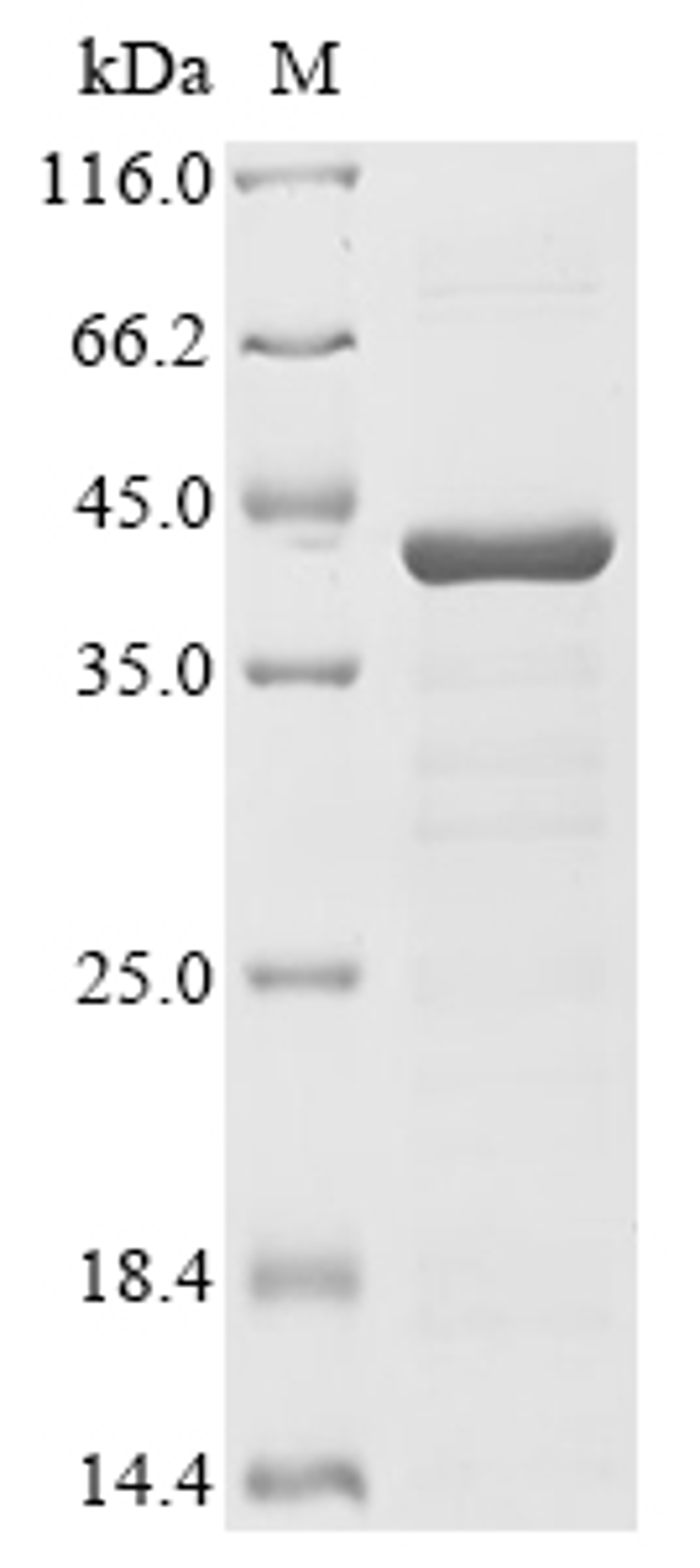 (Tris-Glycine gel) Discontinuous SDS-PAGE (reduced) with 5% enrichment gel and 15% separation gel.