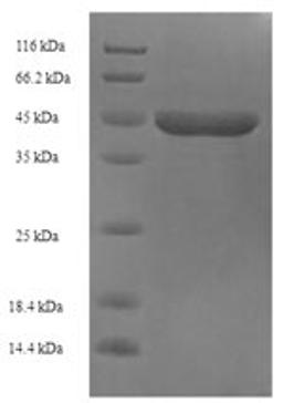 (Tris-Glycine gel) Discontinuous SDS-PAGE (reduced) with 5% enrichment gel and 15% separation gel.