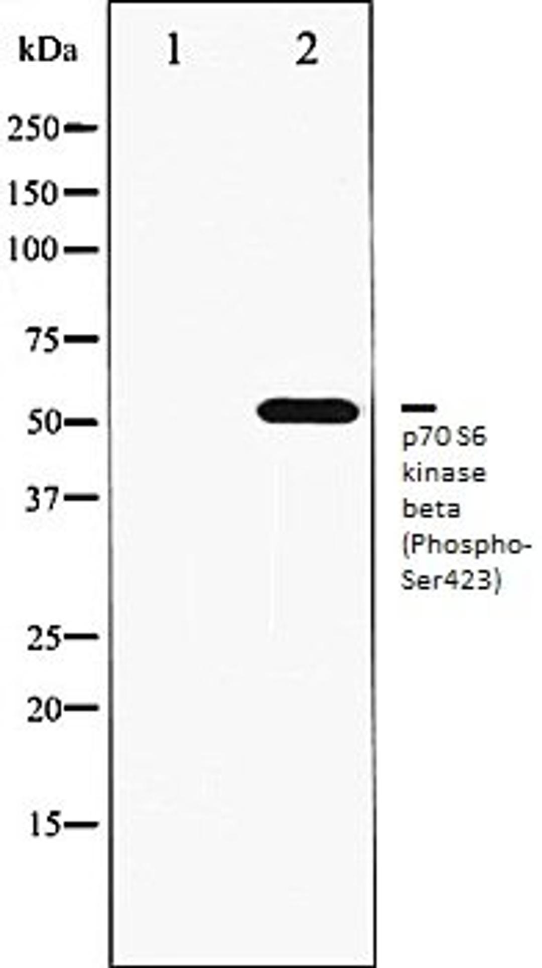 Western blot analysis of K562 whole cell lysates using p70 S6 Kinase beta (Phospho-Ser423) antibody, The lane on the left is treated with the antigen-specific peptide.