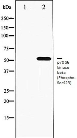 Western blot analysis of K562 whole cell lysates using p70 S6 Kinase beta (Phospho-Ser423) antibody, The lane on the left is treated with the antigen-specific peptide.