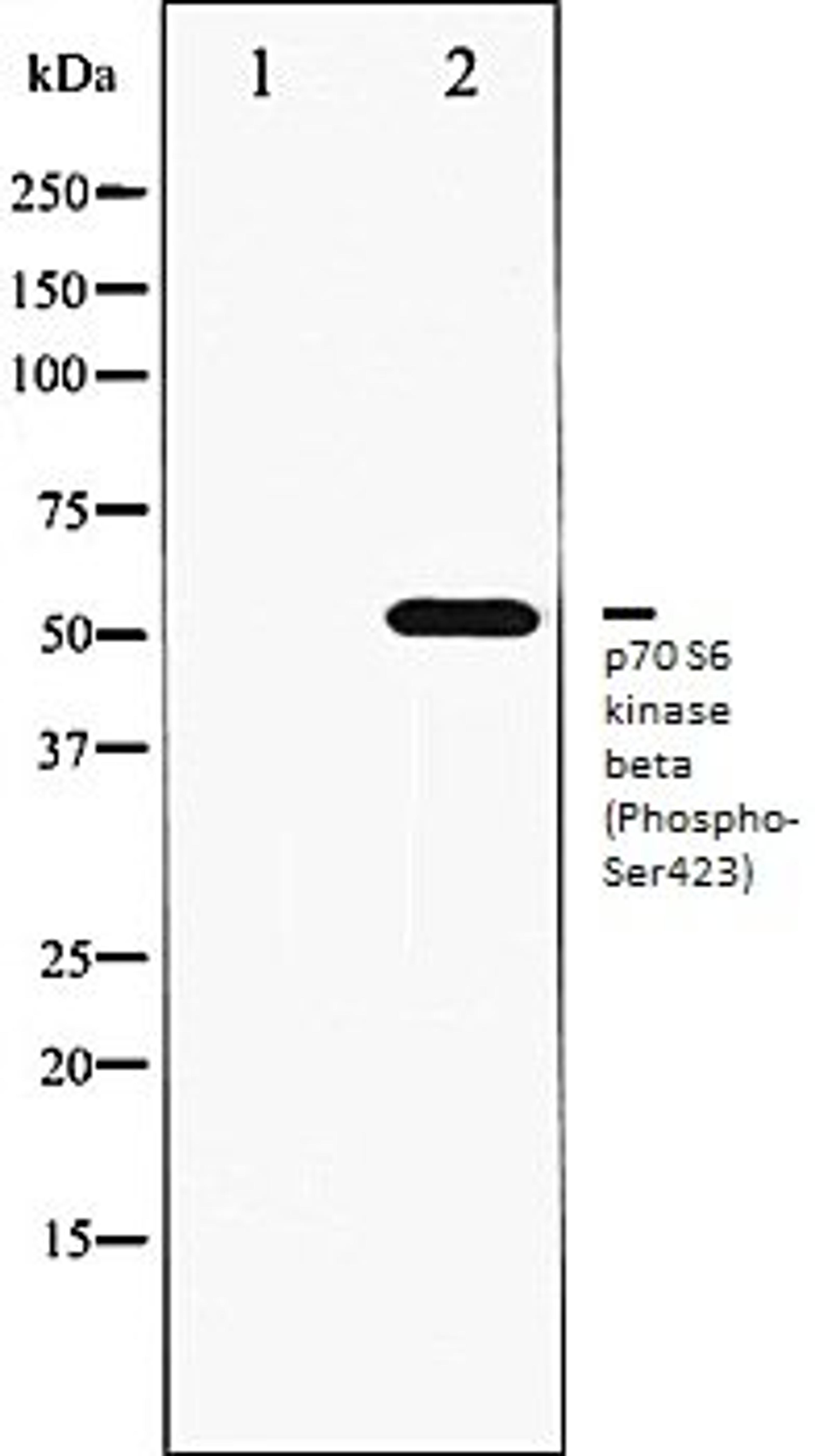 Western blot analysis of K562 whole cell lysates using p70 S6 Kinase beta (Phospho-Ser423) antibody, The lane on the left is treated with the antigen-specific peptide.