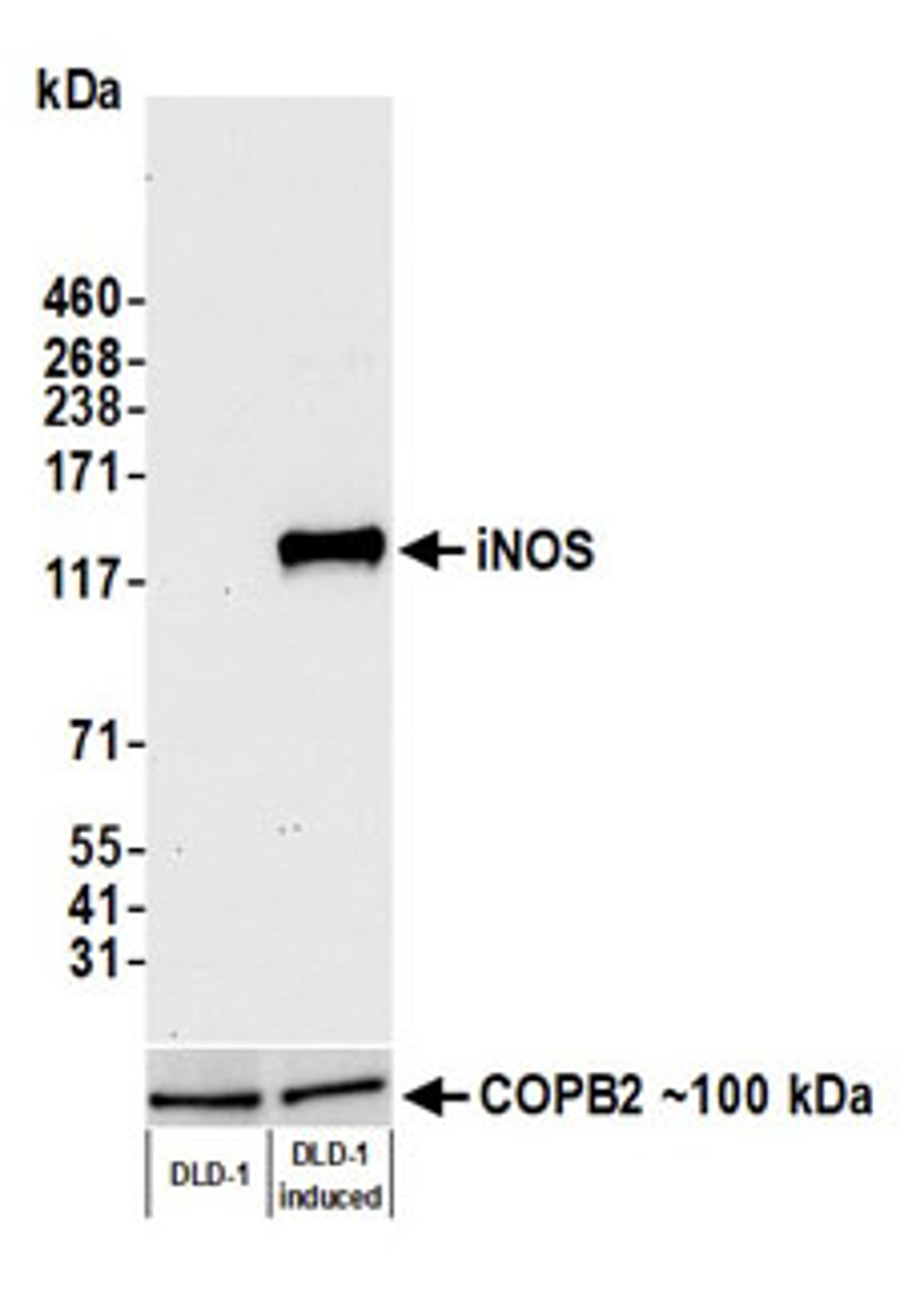 Detection of human iNOS by western blot.