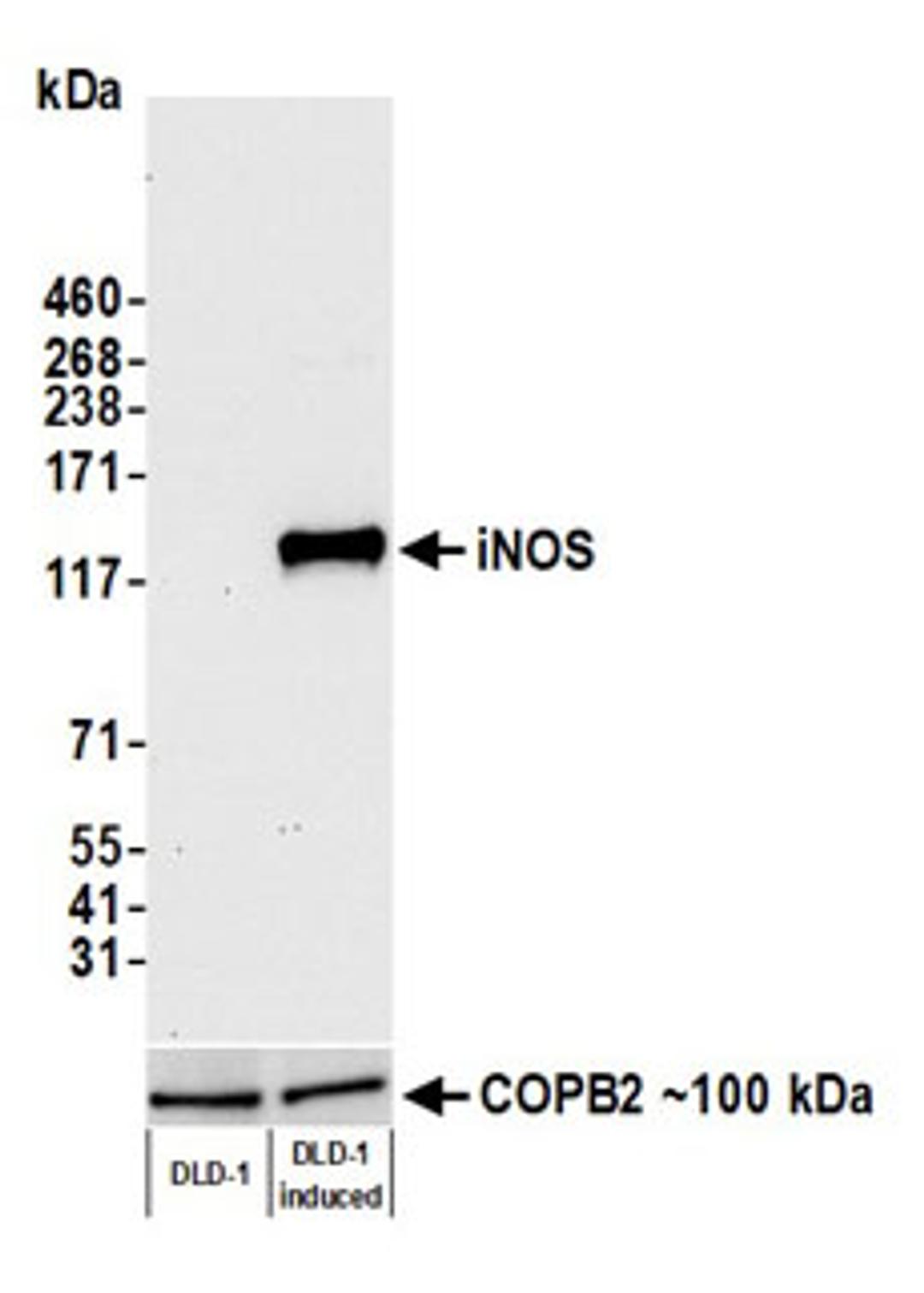 Detection of human iNOS by western blot.