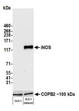 Detection of human iNOS by western blot.