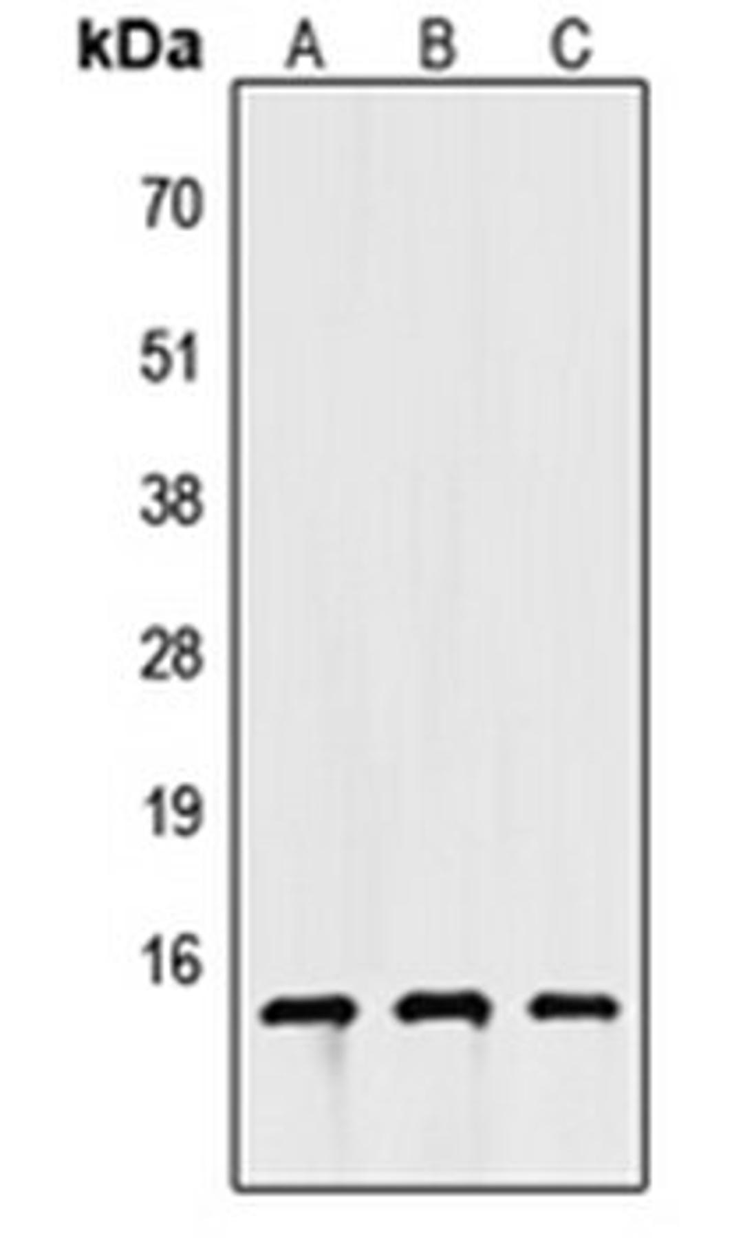 Western blot analysis of HEK293T (Lane 1), NS-1 (Lane 2), H9C2 (Lane 3) whole cell lysates using Apolipoprotein C4 antibody