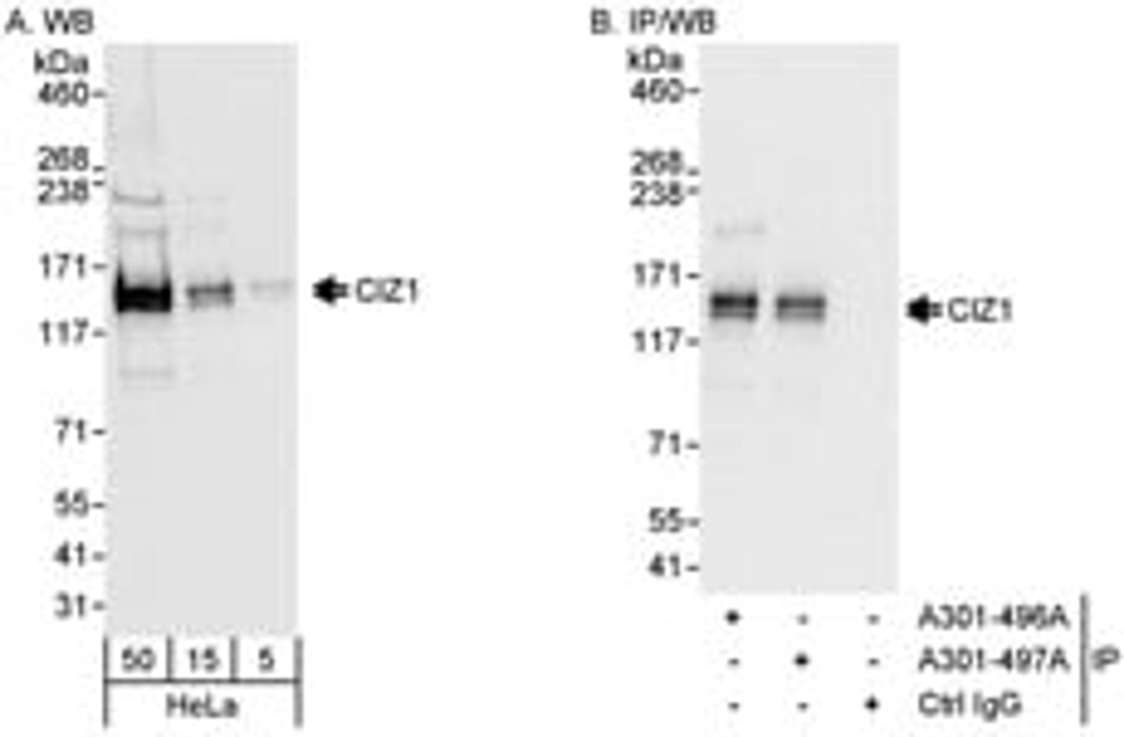 Detection of human CIZ1 by western blot and immunoprecipitation.