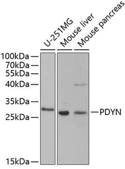 Western blot - PDYN antibody (A5830)