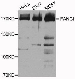 Western blot analysis of extracts of various cells using FANCI antibody