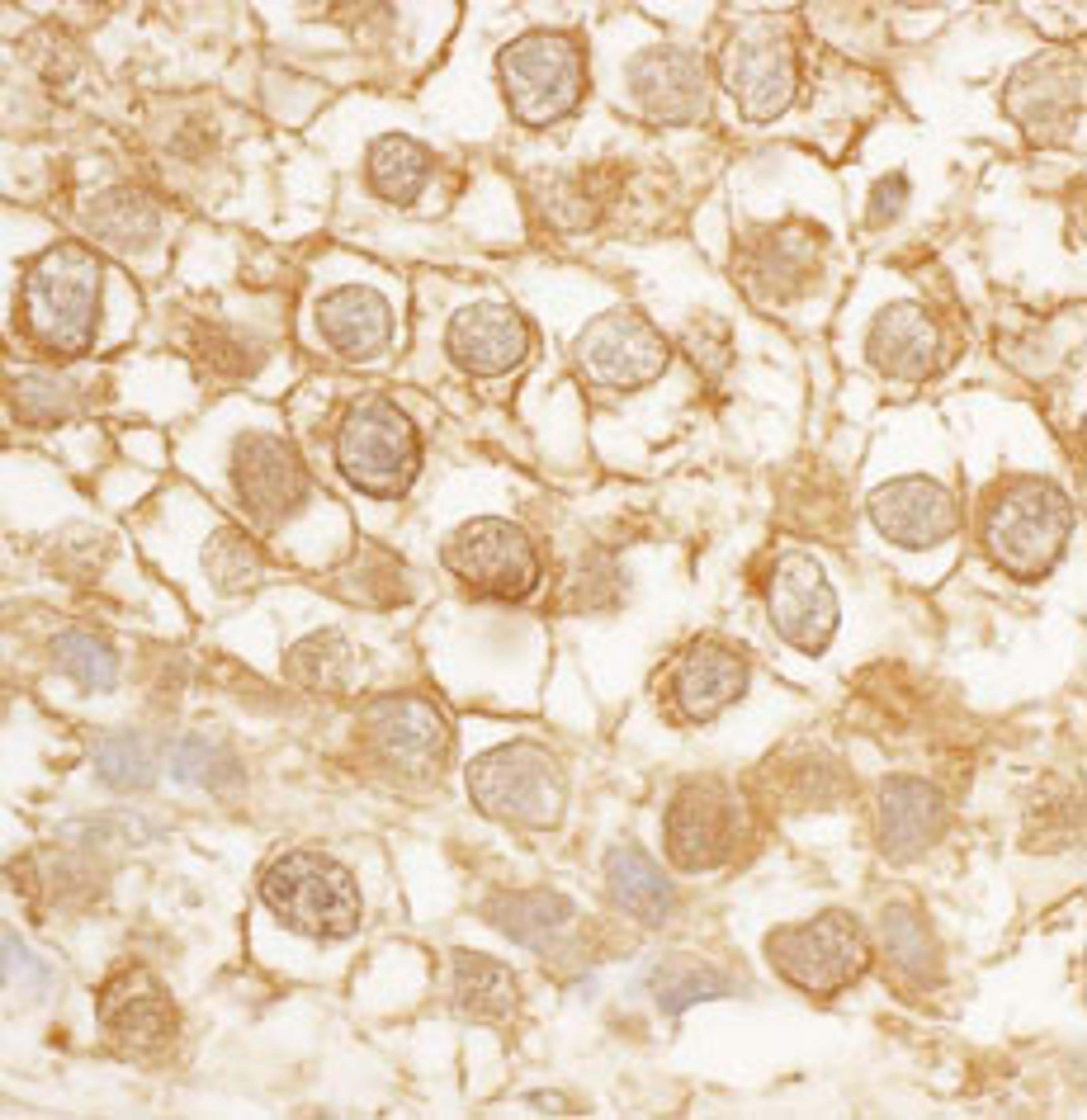 Detection of human BORG4 by immunohistochemistry.