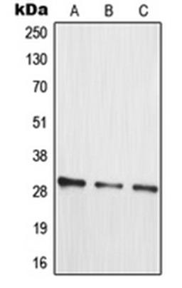 Western blot analysis of HT29 (Lane 1), Jurkat (Lane 2), HepG2 (Lane 3) whole cell lysates using MRPL10 antibody