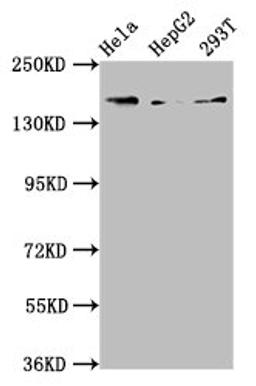 Western Blot. Positive WB detected in: Hela whole cell lysate, HepG2 whole cell lysate, 293T whole cell lysate. All lanes: C4A antibody at 3.9ug/ml. Secondary. Goat polyclonal to rabbit IgG at 1/50000 dilution. Predicted band size: 193, 188 kDa. Observed band size: 193 kDa. 