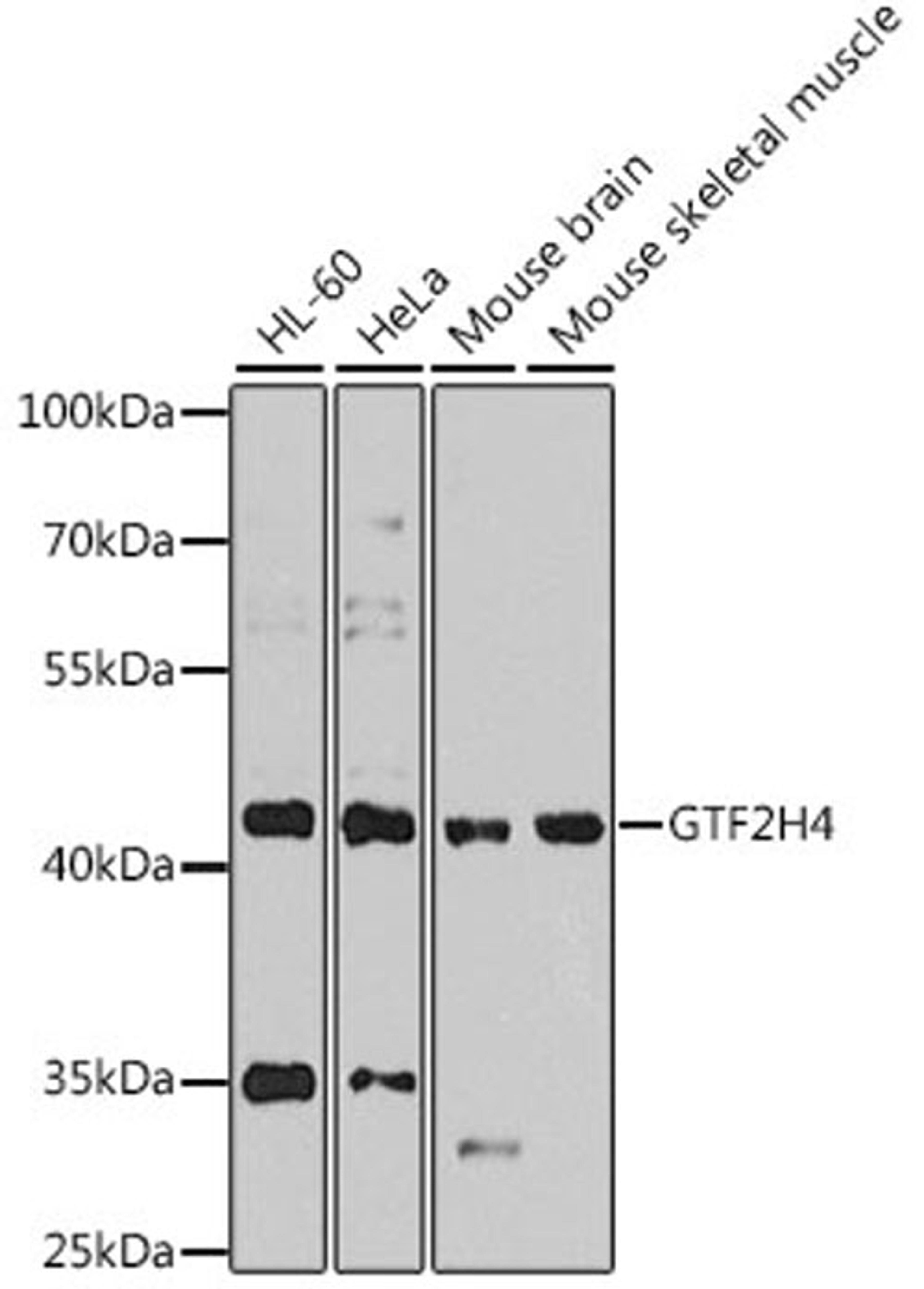 Western blot - GTF2H4 antibody (A8425)