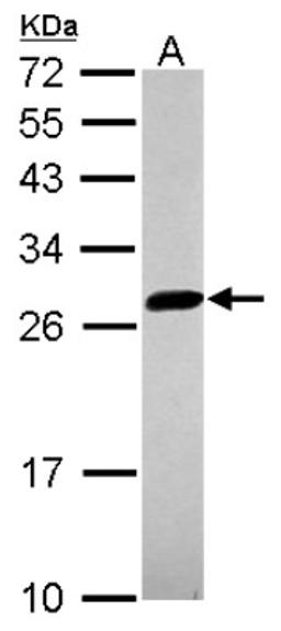 Western Blot: UBE2S Antibody [NBP2-20788] - Sample (30 ug of whole cell lysate) A: HCT116 12% SDS PAGE gel, diluted at 1:1000.