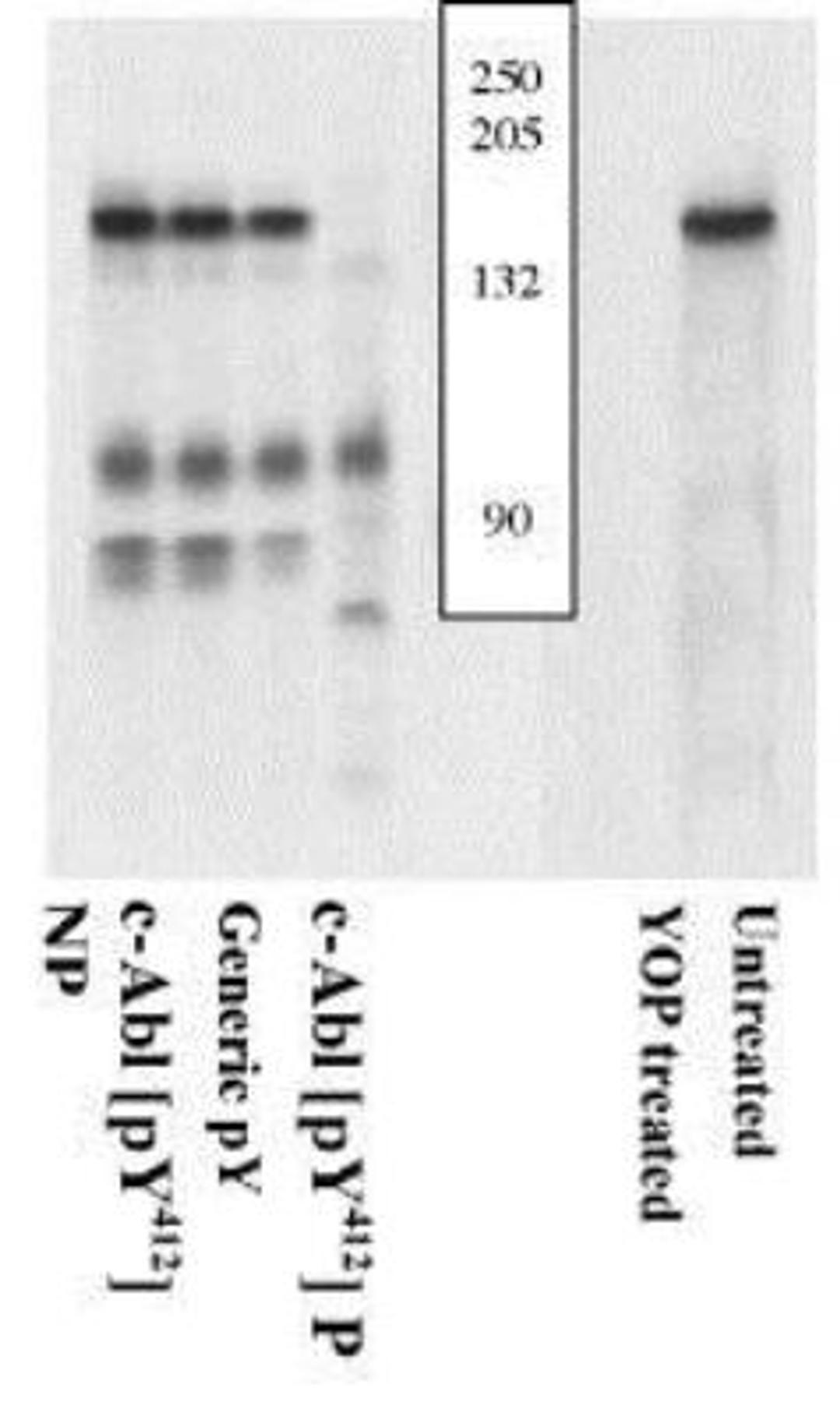 Western Blot: c Abl [p Tyr412] Antibody [NSB252] - Extracts of fibroblasts infected w/ oncogenic dSH3-Abl (1-4) or recombinant phosphorylated c-Abl (5, 6) were resolved by SDS-PAGE on a 10% Tris-glycine gel and transferred to PVDF. The membrane was either treated with YOP phosphatase (5) or untreated (1-4, 6), blocked with 5% BSA-TBST buffer ON at 4C, and then incubated with Ab for 2hrs at RT in a 3% BSA-TBST buffer, following prior incubation w/ no peptide (1, 5, 6), non-phosphopeptide corresponding to the immunogen (2), generic phosphotyrosine containing peptide (3), the phosphopeptide immunogen (4). Only the peptide corresponding to NSB252 blocks the Ab signal, demonstrating the specificity of the Ab. Phosphatase stripping eliminates the signal, verifying the Ab is phospho-specific.