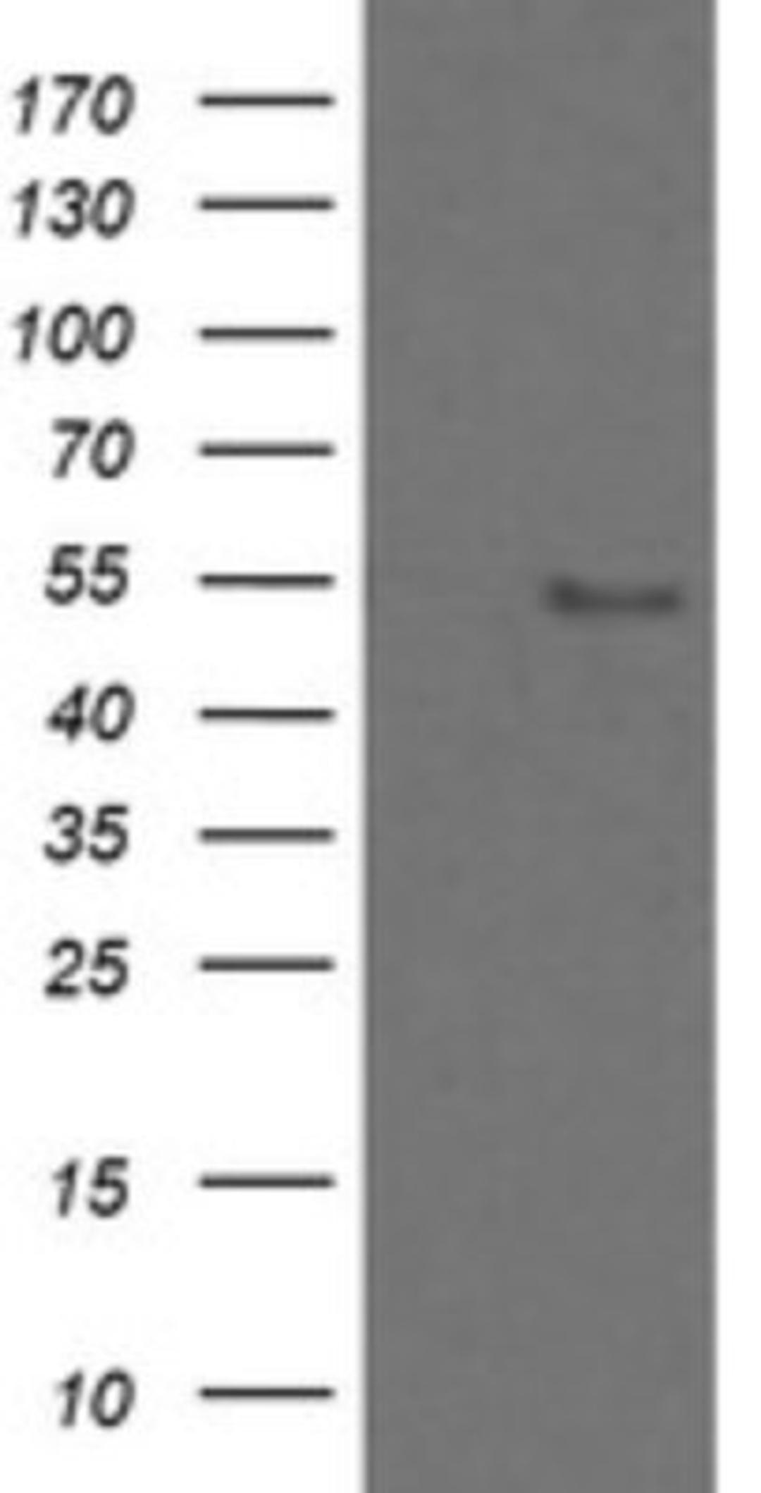 Western Blot: ZNF447 Antibody (2H7) [NBP2-45442] - Analysis of HEK293T cells were transfected with the pCMV6-ENTRY control (Left lane) or pCMV6-ENTRY ZNF447.