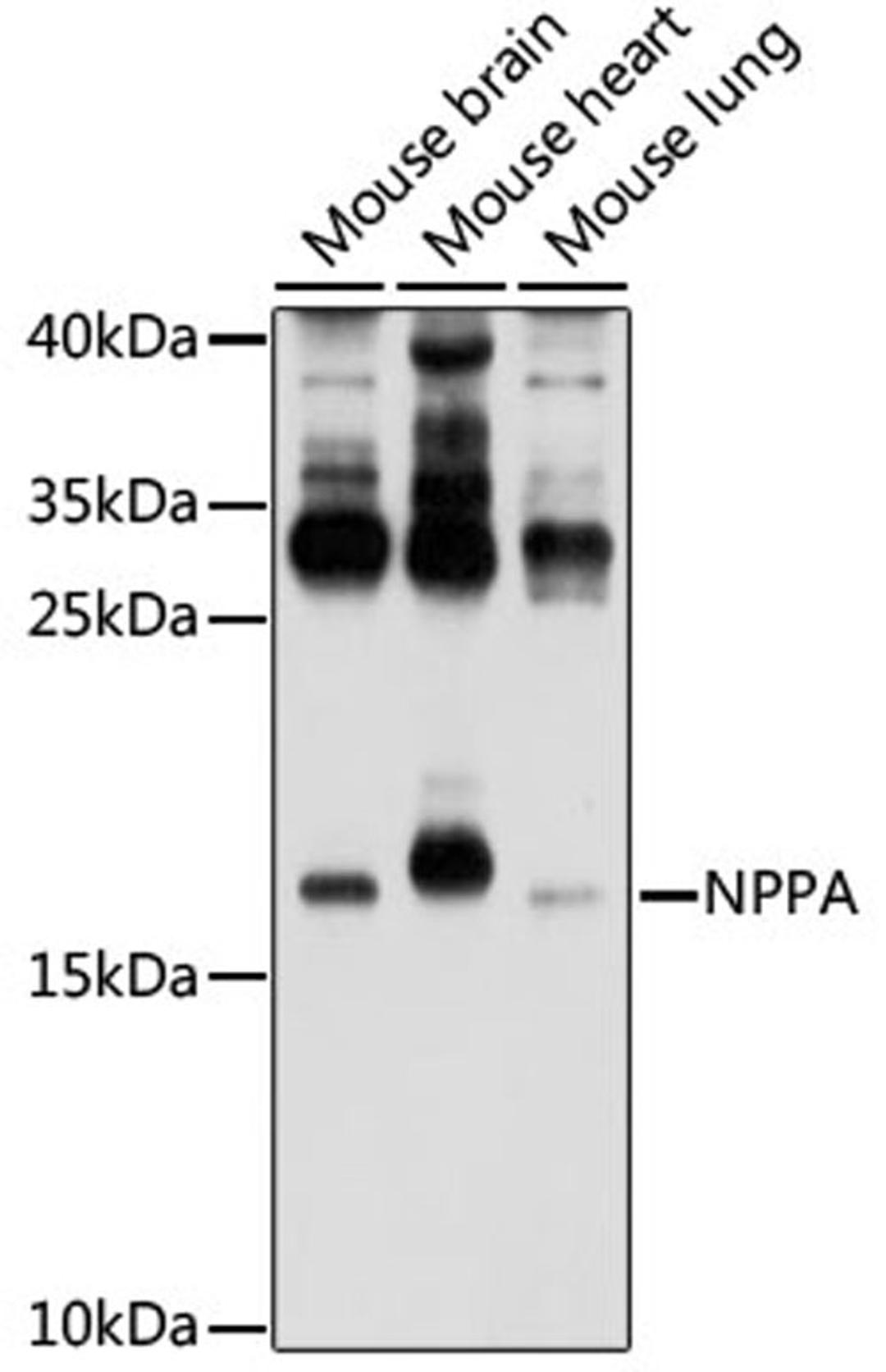 Western blot - NPPA antibody (A1609)