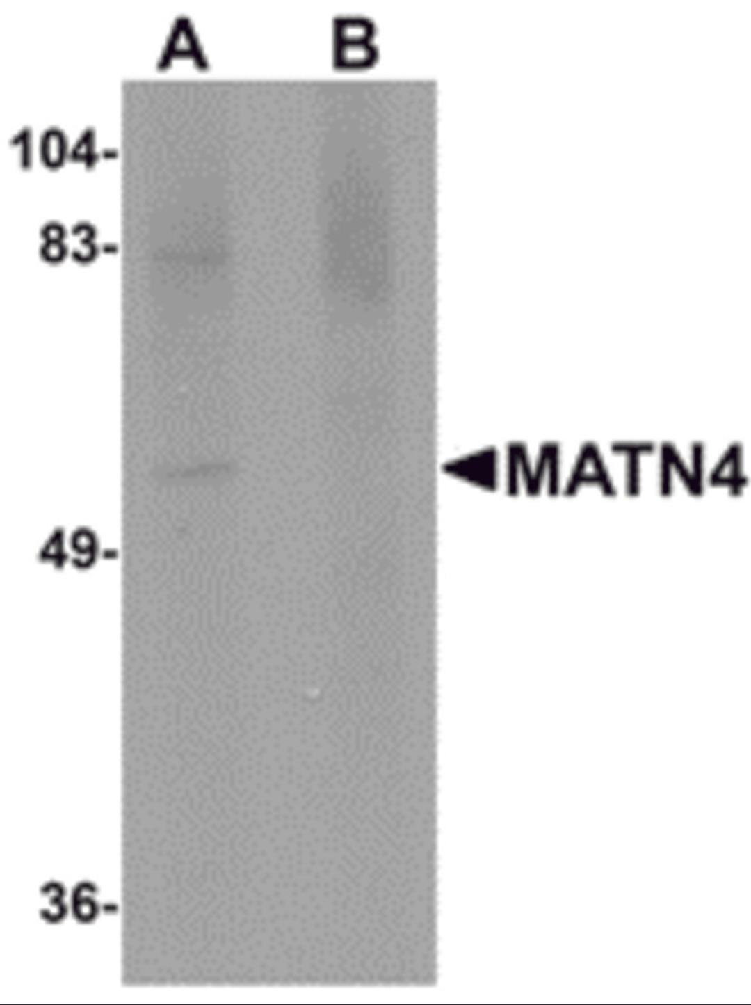 Western blot analysis of MATN4 in rat brain tissue lysate with MATN4 antibody at 1 μg/mL in (A) the absence and (B) the presence of blocking peptide.