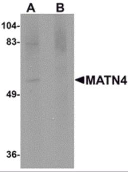 Western blot analysis of MATN4 in rat brain tissue lysate with MATN4 antibody at 1 μg/mL in (A) the absence and (B) the presence of blocking peptide.