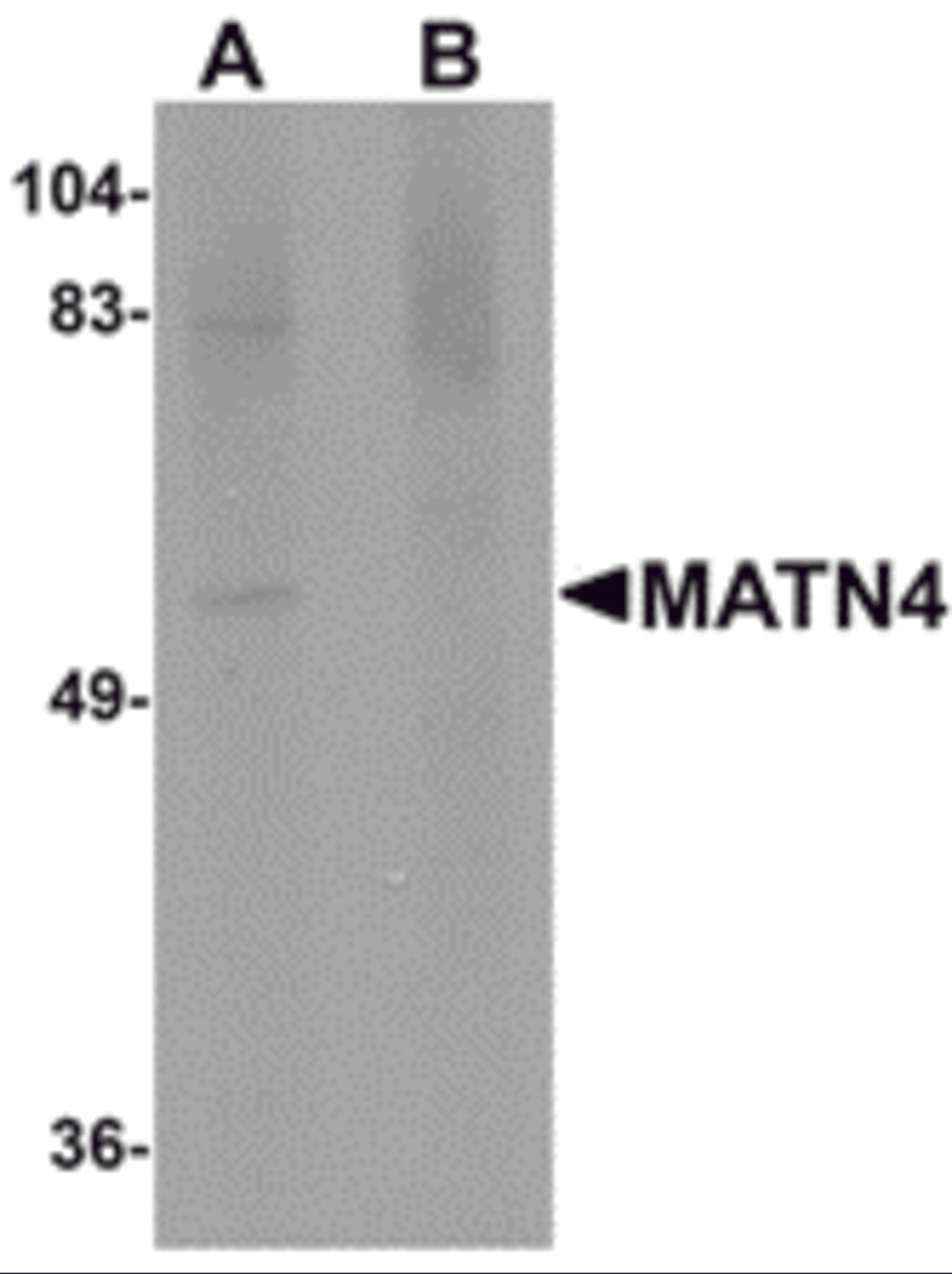 Western blot analysis of MATN4 in rat brain tissue lysate with MATN4 antibody at 1 μg/mL in (A) the absence and (B) the presence of blocking peptide.