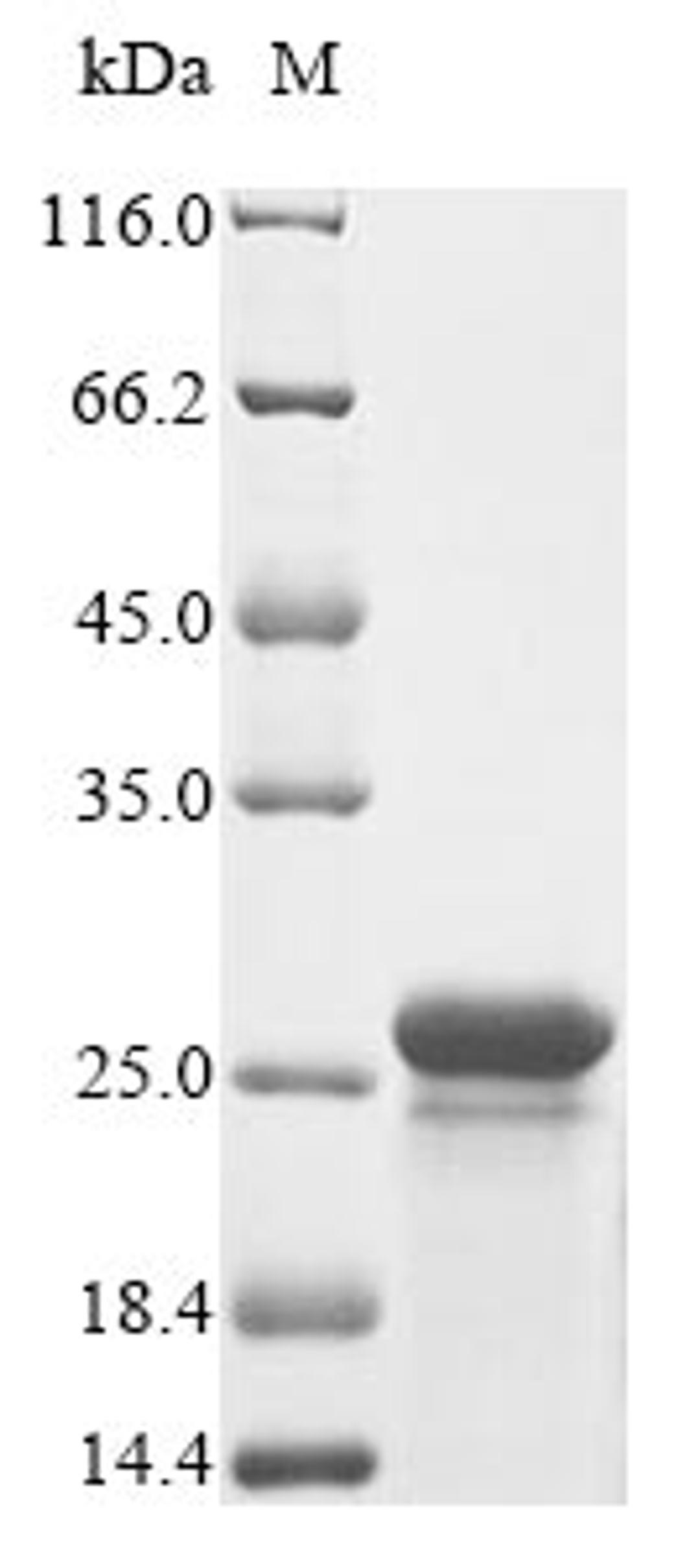 (Tris-Glycine gel) Discontinuous SDS-PAGE (reduced) with 5% enrichment gel and 15% separation gel.