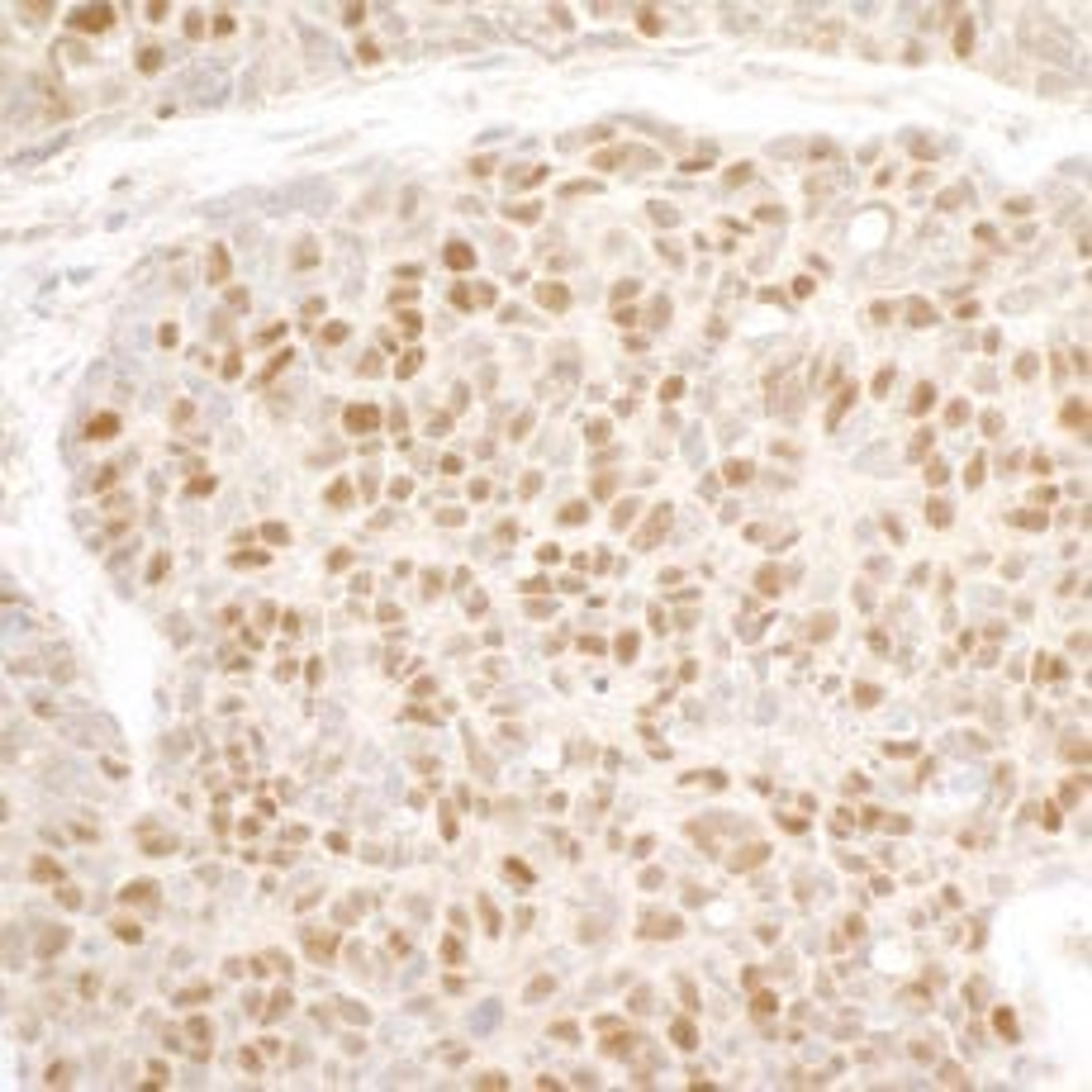 Detection of human MCM3 by immunohistochemistry.