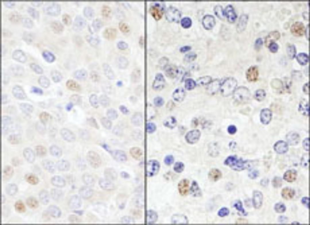 Detection of human and mouse DDX46 by immunohistochemistry.