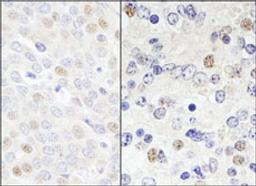 Detection of human and mouse DDX46 by immunohistochemistry.