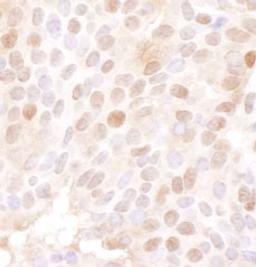 Detection of human MCM4 by immunohistochemistry.