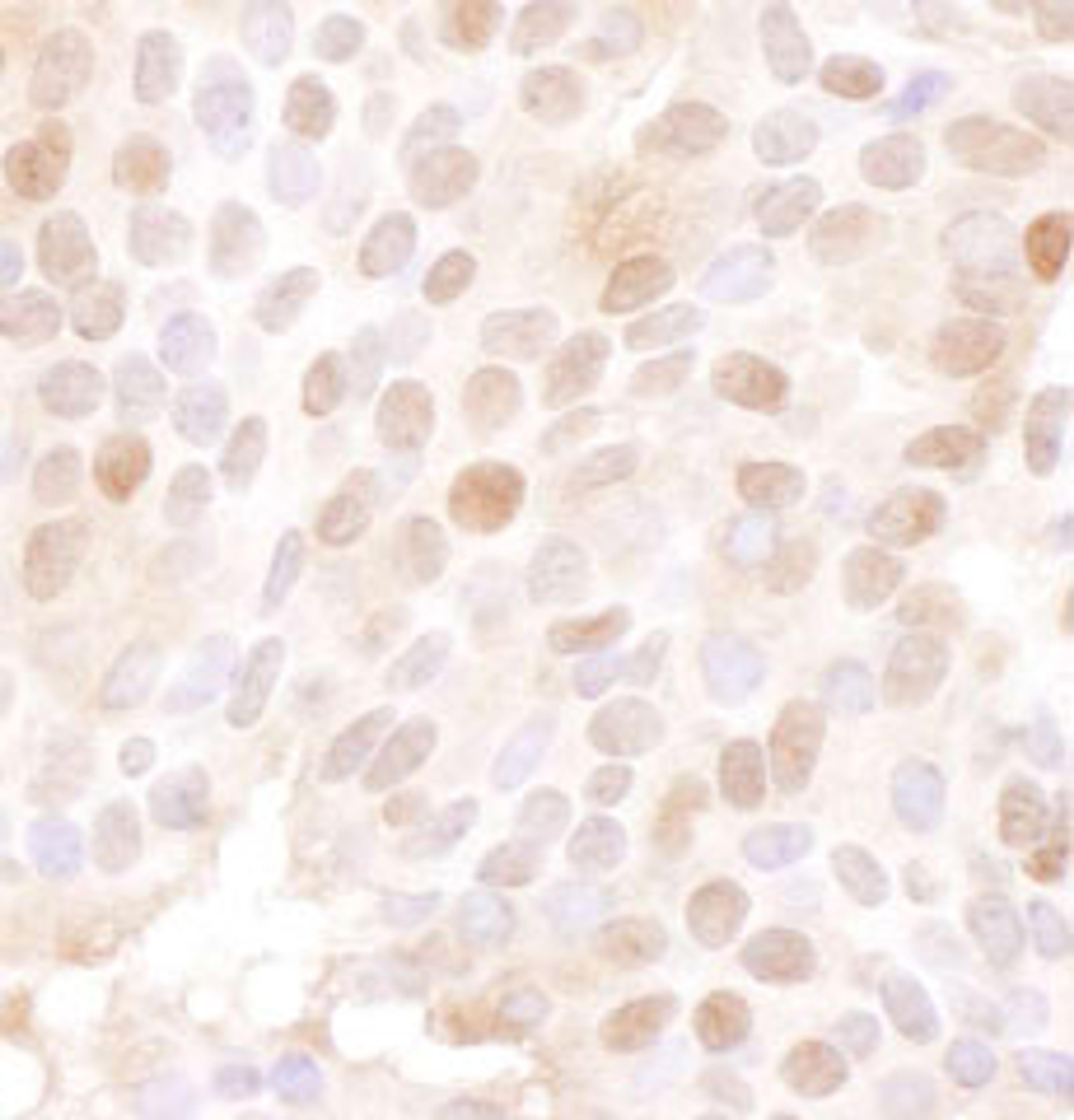 Detection of human MCM4 by immunohistochemistry.