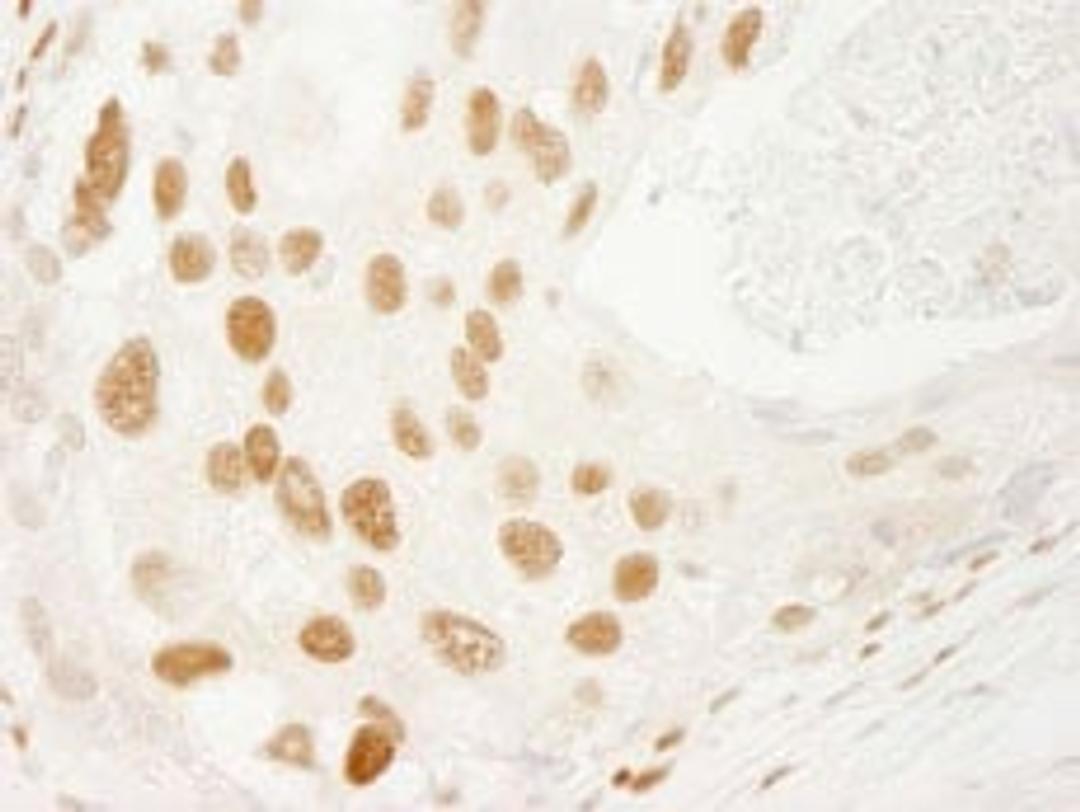 Detection of human PML by immunohistochemistry.