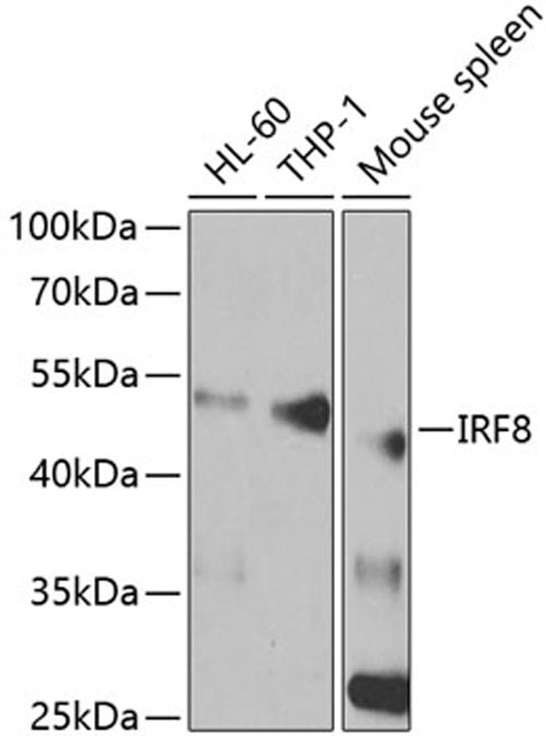 Western blot - IRF8 antibody (A5798)