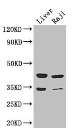 Western Blot. Positive WB detected in: Mouse liver tissue, Raji whole cell lysate. All lanes: BHMT2 antibody at 3µg/ml. Secondary. Goat polyclonal to rabbit IgG at 1/50000 dilution. Predicted band size: 41, 34 kDa. Observed band size: 41, 34 kDa