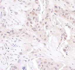 Detection of human GAPDH by immunohistochemistry.