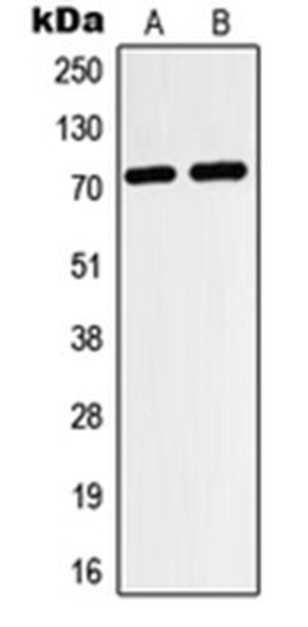 Western blot analysis of HeLa (Lane 1), HepG2 (Lane 2) whole cell lysates using HIF3A antibody