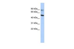 Antibody used in WB on Human HT1080 at 0.2-1 ug/ml.