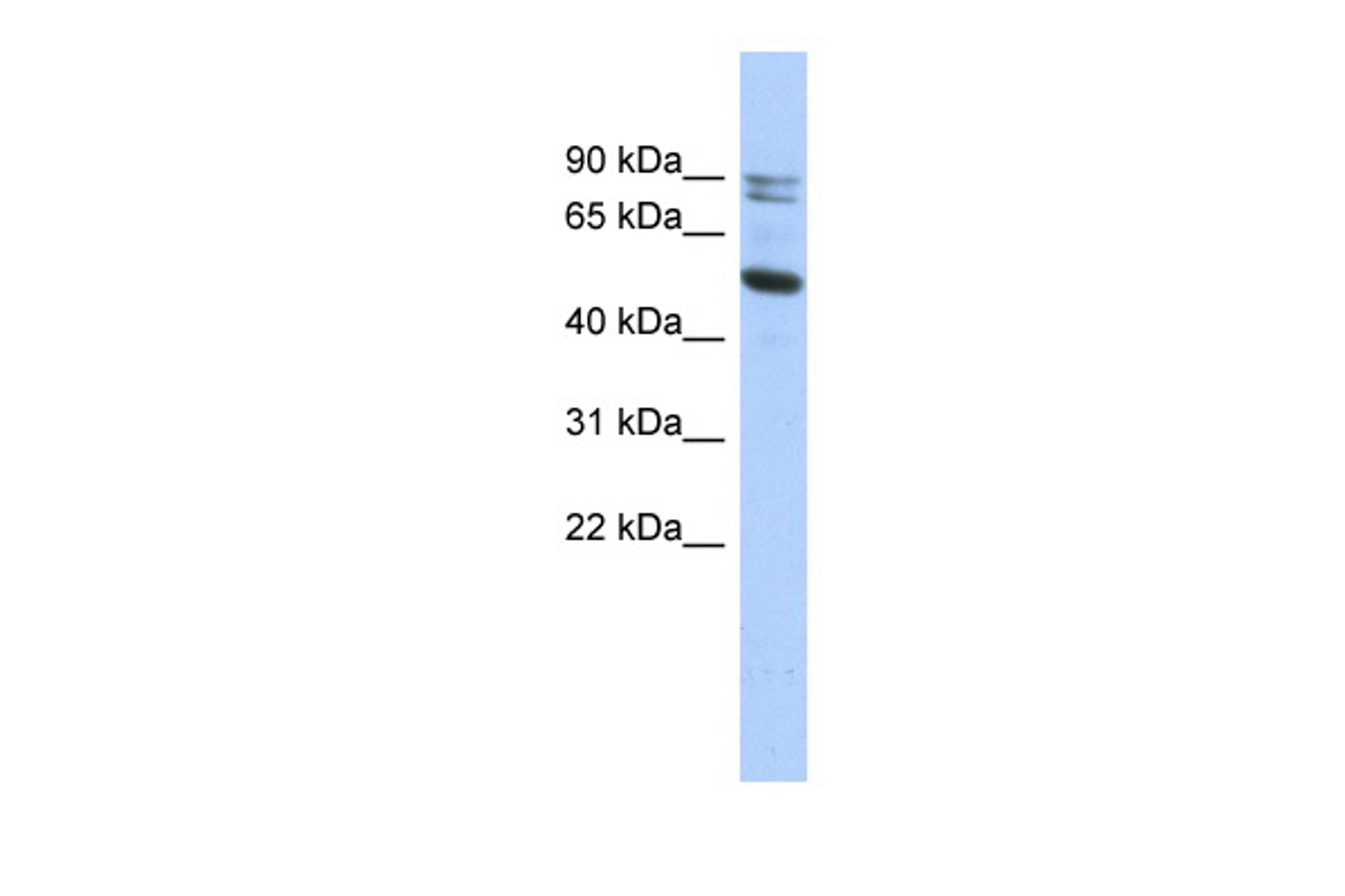 Antibody used in WB on Human HT1080 at 0.2-1 ug/ml.