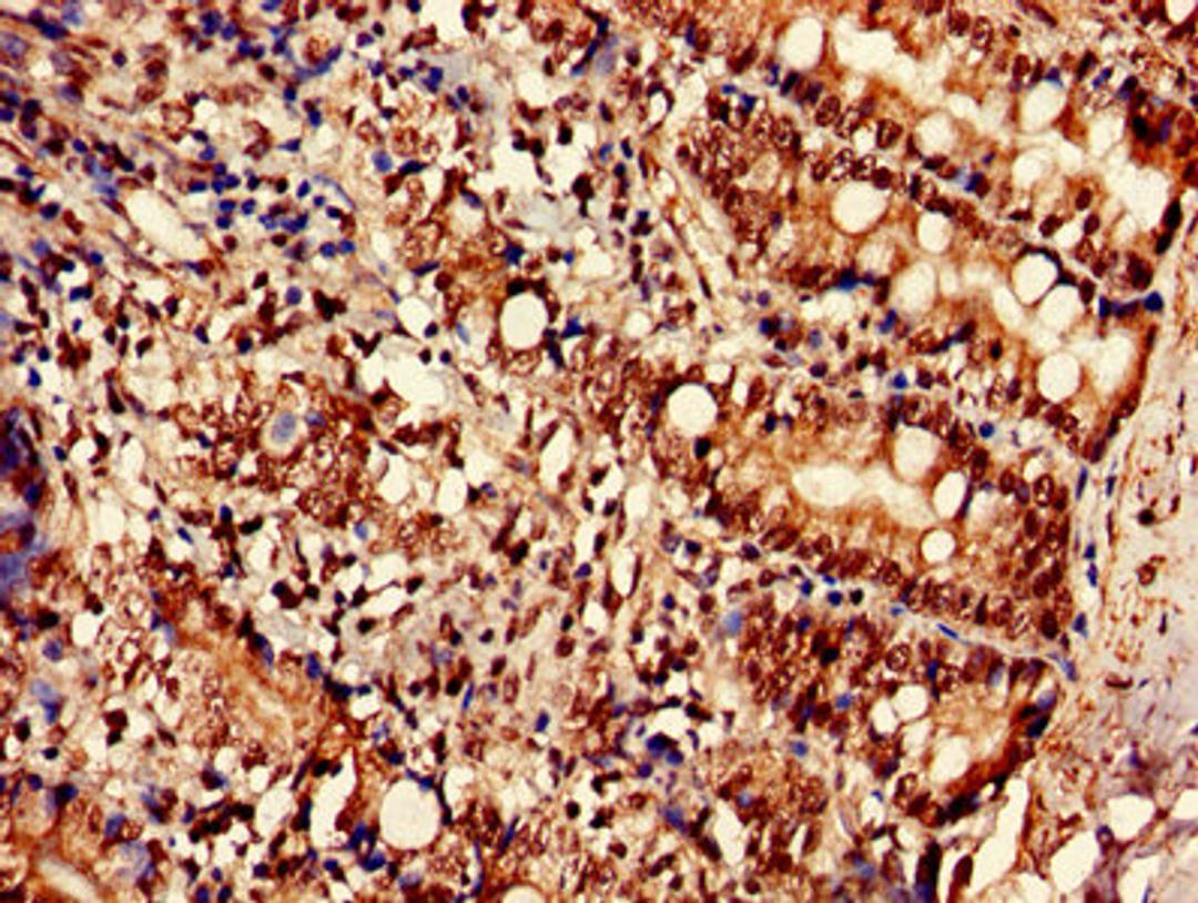 Immunohistochemistry of paraffin-embedded human small intestine tissue using CSB-PA809010LA01HU at dilution of 1:100