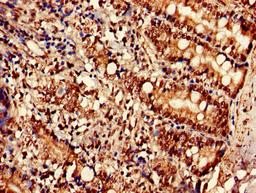 Immunohistochemistry of paraffin-embedded human small intestine tissue using CSB-PA809010LA01HU at dilution of 1:100