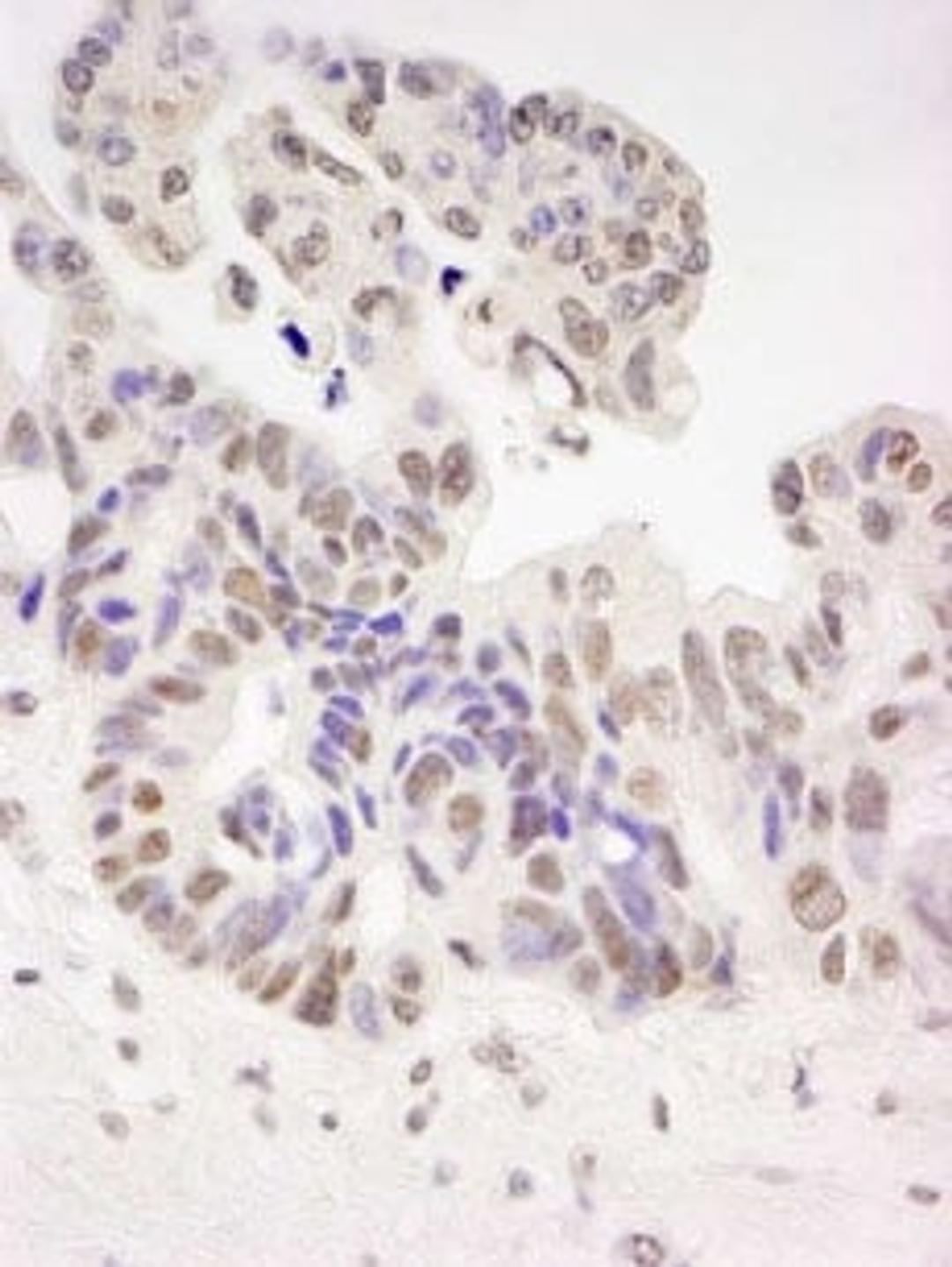 Detection of human Tat-SF1 by immunohistochemistry.