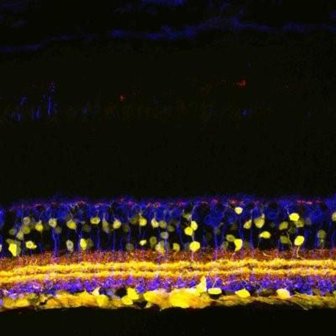 Immunohistochemistry: SHANK1 Antibody [NB300-167] - Mouse retina using NB300-167.