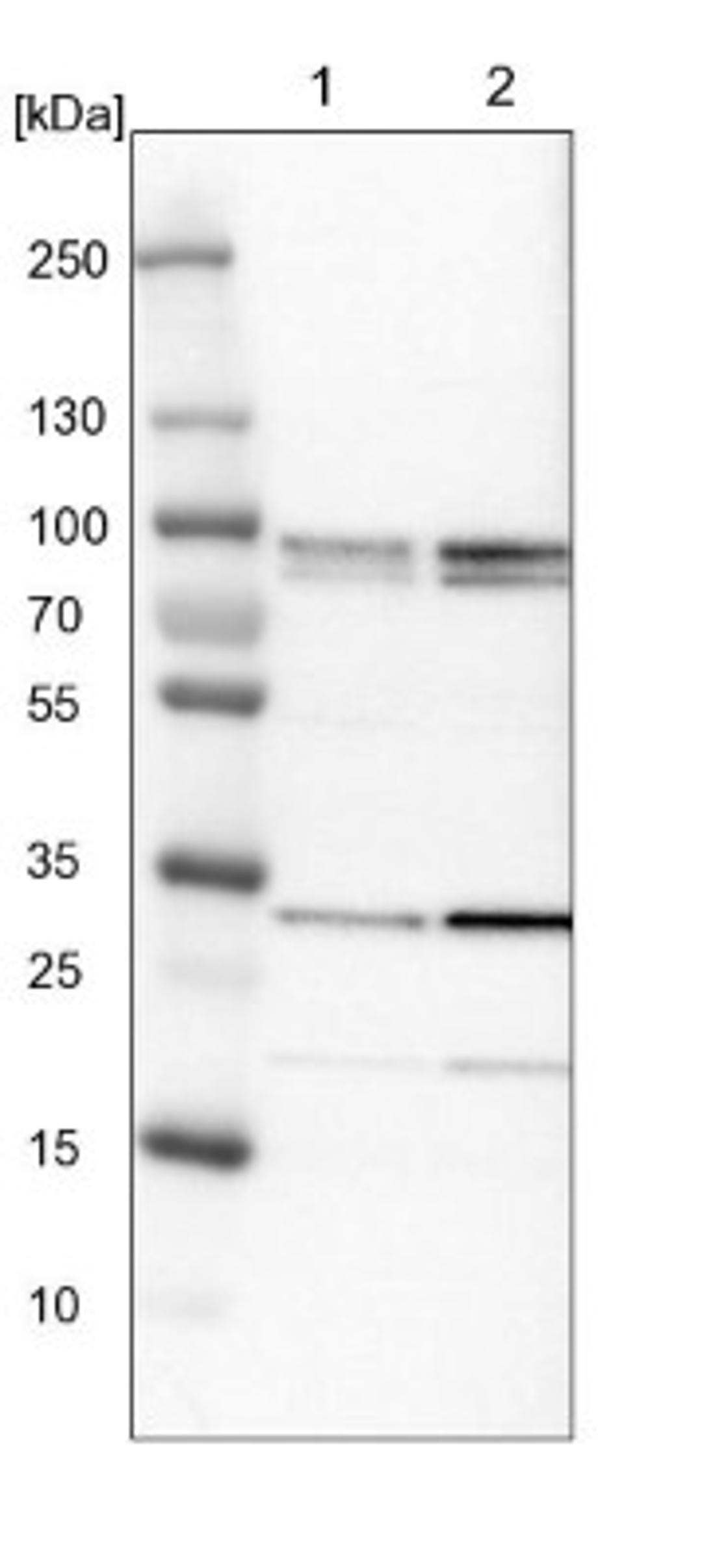 Western Blot: MAK10 Antibody [NBP1-90032] - Lane 1: NIH-3T3 cell lysate (Mouse embryonic fibroblast cells)<br/>Lane 2: NBT-II cell lysate (Rat Wistar bladder tumour cells)