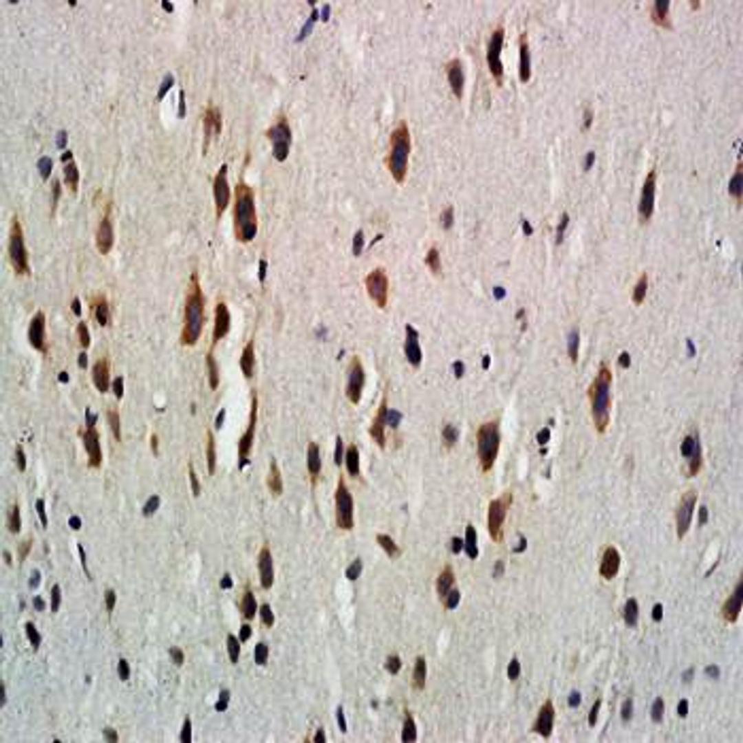 Immunohistochemical analysis of formalin-fixed and paraffin embedded rat brain tissue at (Dilution at:1:600) using CD114 antibody