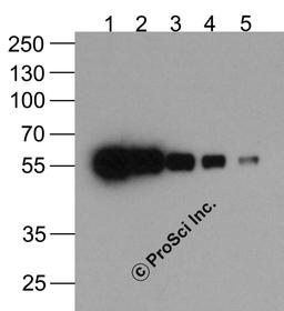 Western blot analysis (1) 200ng, (2) 100ng, (3) 50ng, (4) 25ng, and (5) 12.5ng of a HAT-tagged recombinant protein using biotinylated anti-HAT-tag monoclonal antibody at 0.5 μg/ml.