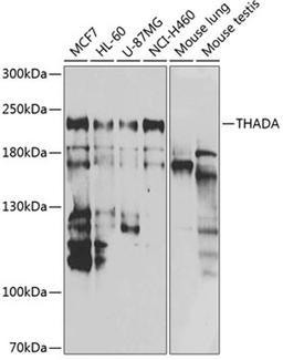 Western blot - THADA antibody (A7129)