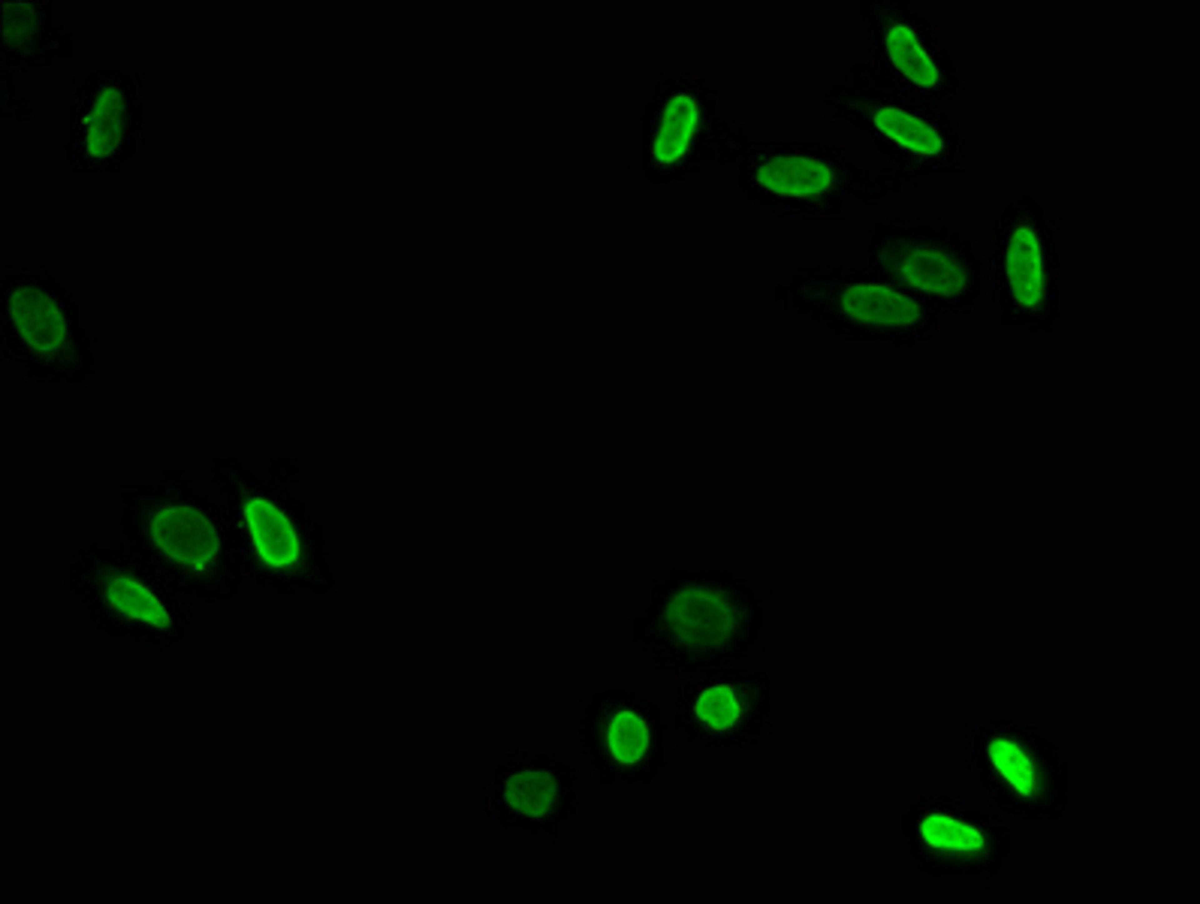 Immunofluorescence staining of Hela cells with CSB-PA010418OA79acHU at 1:7.5, counter-stained with DAPI. The cells were fixed in 4% formaldehyde, permeabilized using 0.2% Triton X-100 and blocked in 10% normal Goat Serum. The cells were then incubated with the antibody overnight at 4&deg;C. The secondary antibody was Alexa Fluor 488-congugated AffiniPure Goat Anti-Rabbit IgG(H+L).