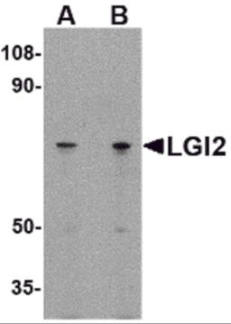 Western blot analysis of LGI2 in 293 cell lysate with LGI2 antibody at (A) 1 and (B) 2 &#956;g/mL.