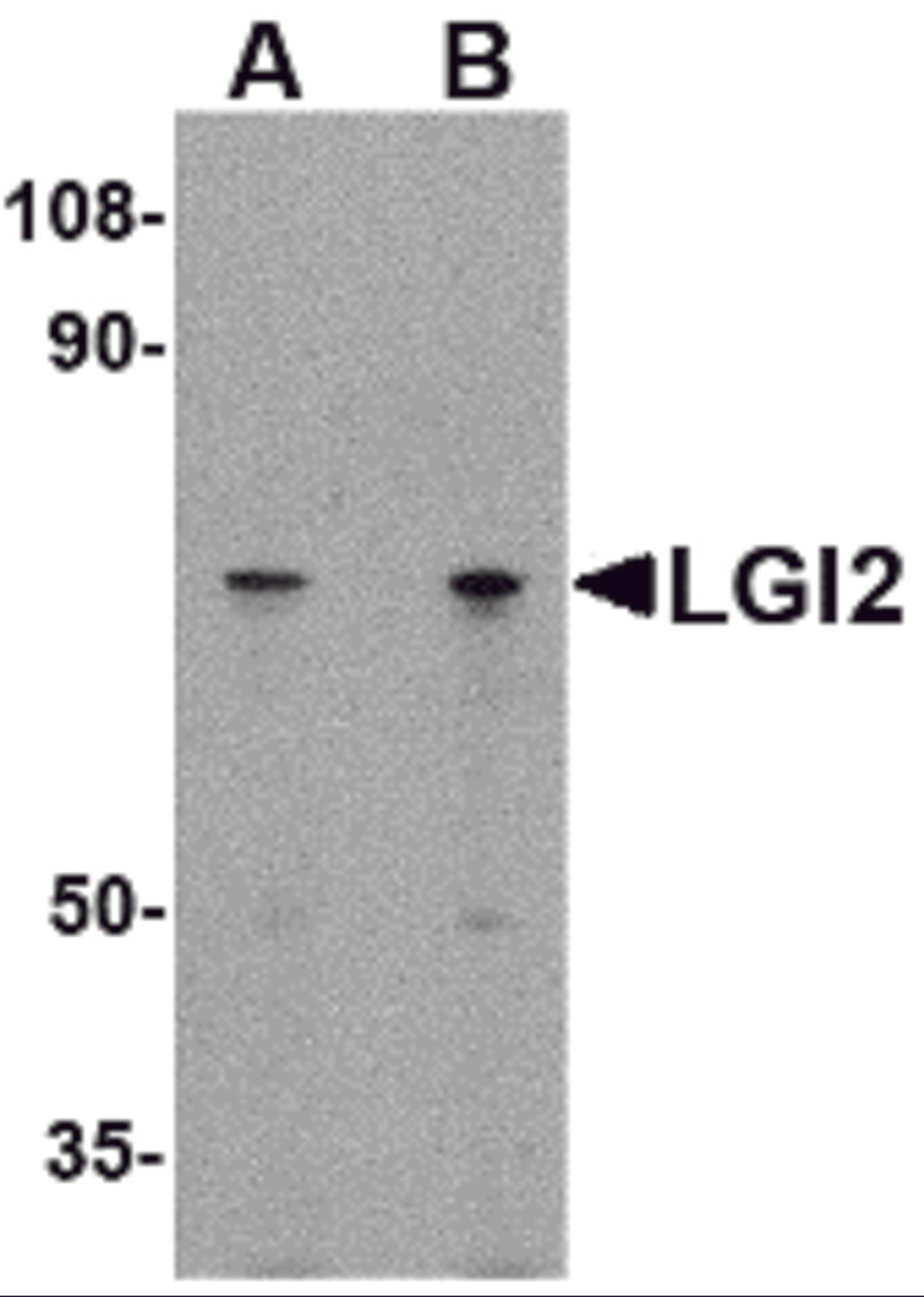 Western blot analysis of LGI2 in 293 cell lysate with LGI2 antibody at (A) 1 and (B) 2 &#956;g/mL.