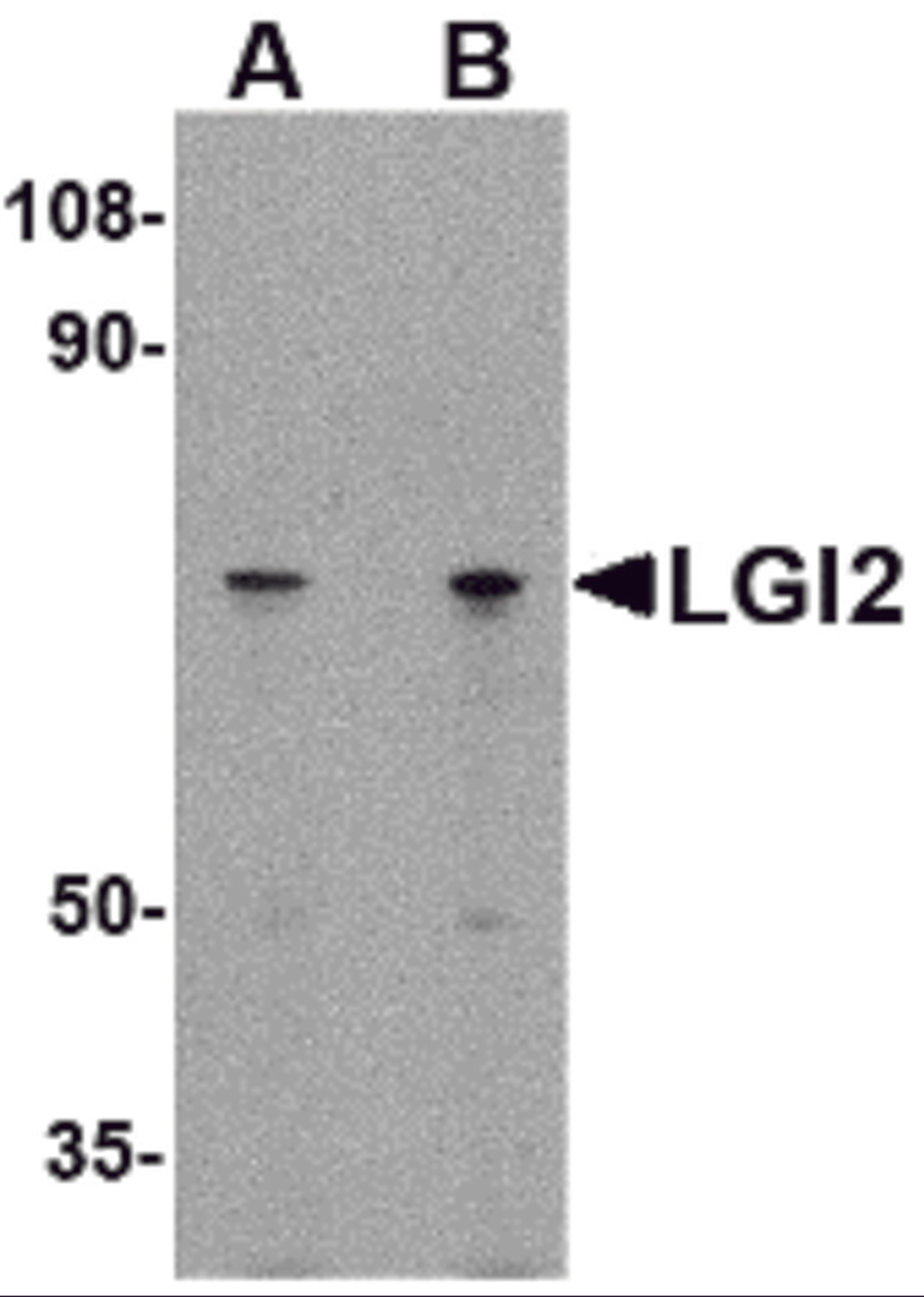 Western blot analysis of LGI2 in 293 cell lysate with LGI2 antibody at (A) 1 and (B) 2 μg/mL.