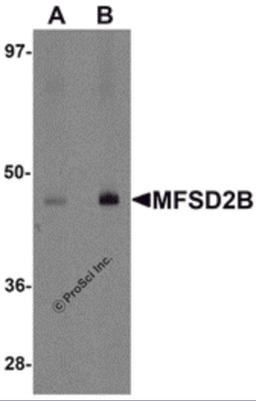 Western blot analysis of MFSD2B in rat lung tissue lysate with MFSD2B antibody at (A) 1 and (B) 2 &#956;g/mL.