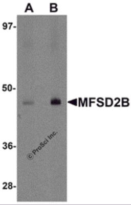 Western blot analysis of MFSD2B in rat lung tissue lysate with MFSD2B antibody at (A) 1 and (B) 2 μg/mL.